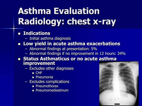 x ray for asthma